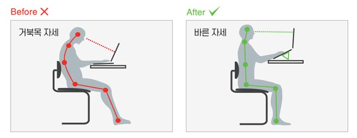 노트북 거북목